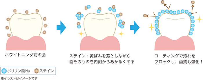 ポリリン酸で行う歯のコーティングの仕組み