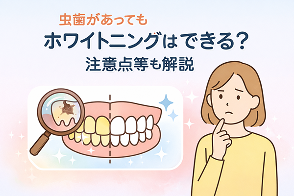 虫歯があってもホワイトニングはできる？注意点等も解説