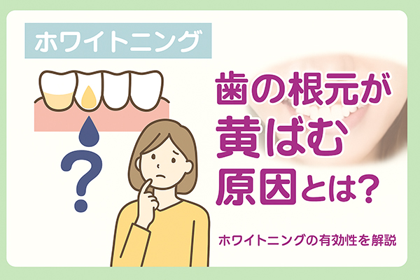 歯の根元が黄ばむ原因とは？ホワイトニングの有効性を解説
